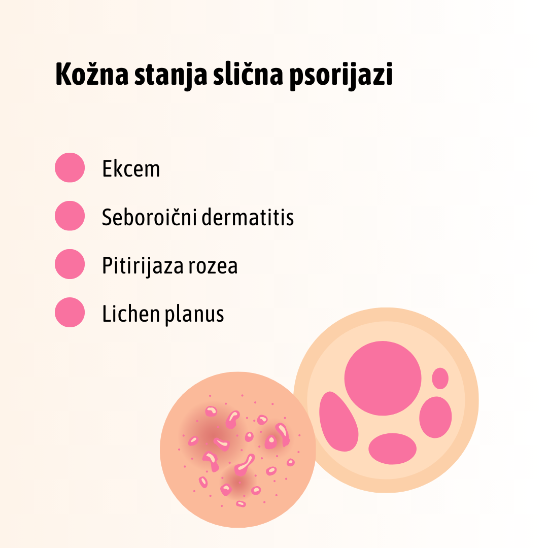 Kako prepoznati psorijazu - grafika